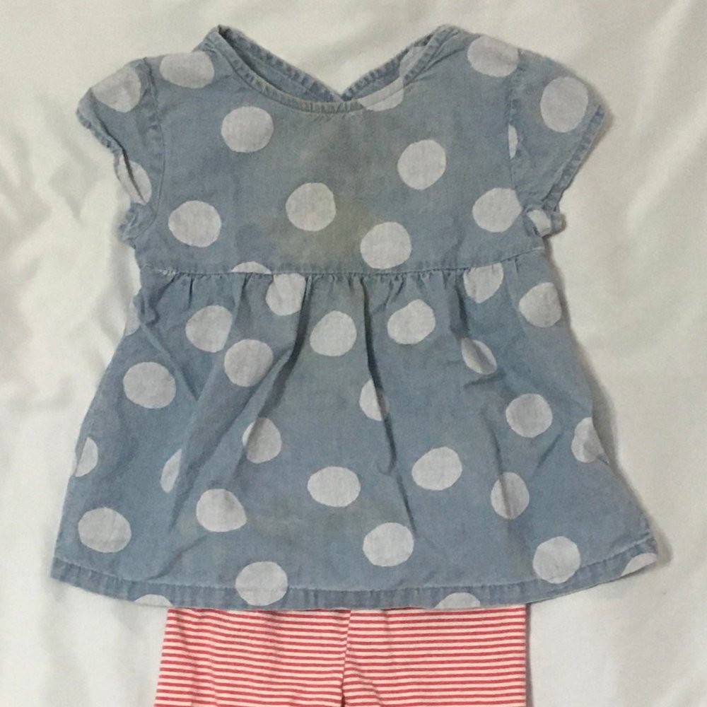 Matching set